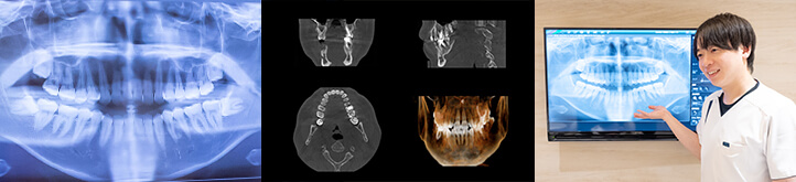 セファロ付き歯科用CT・X線システム