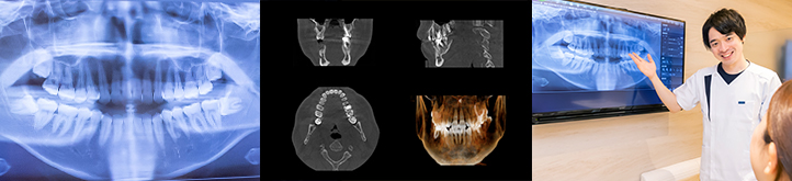 セファロ付き歯科用CT・X線システム