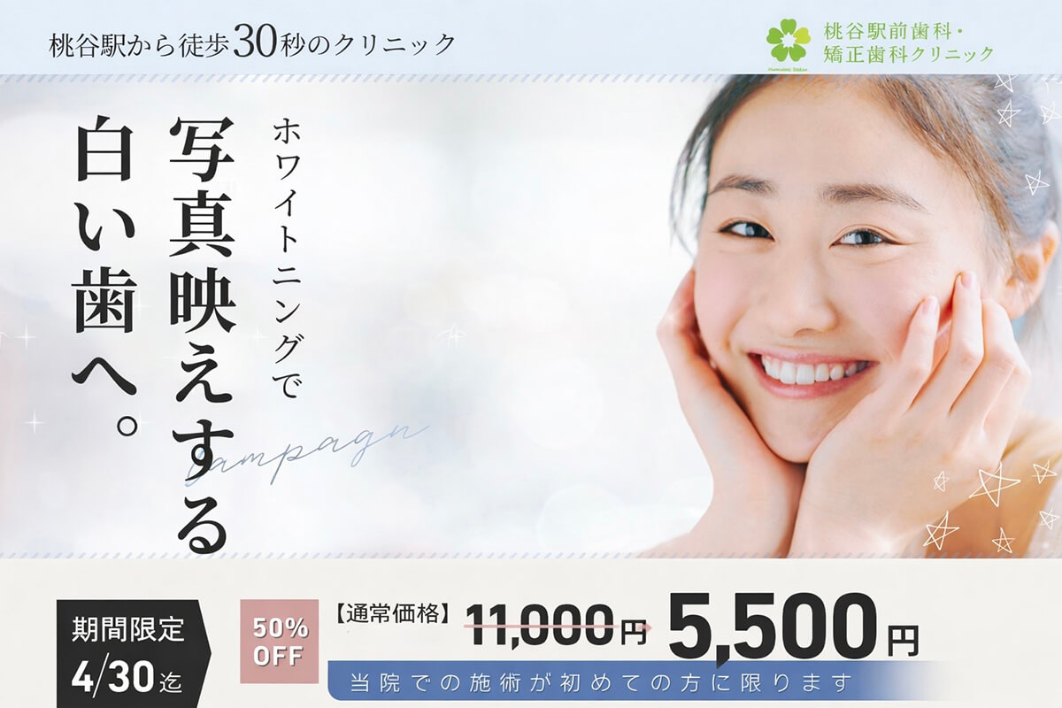 オフィスホワイトニング