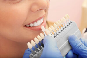 歯を削らずに専用の薬剤を使用して歯を白くするホワイトニング