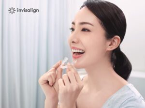 インビザラインの特徴：取り外しができる