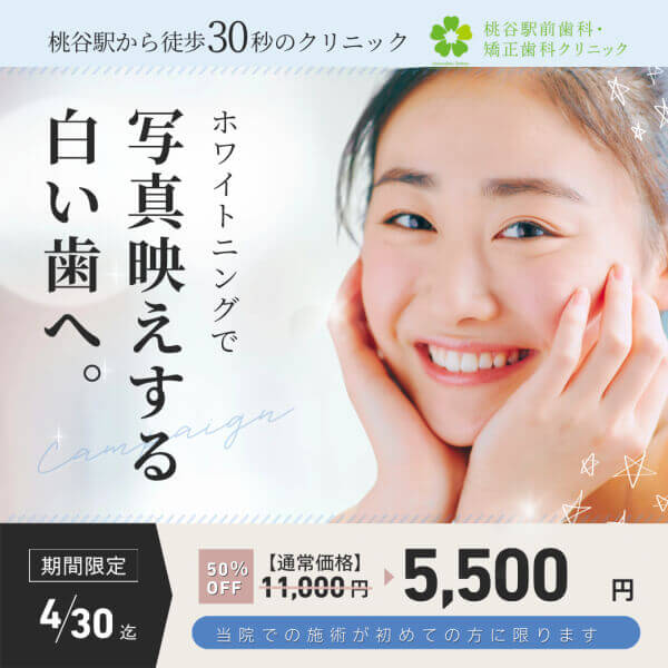 ホワイトニング